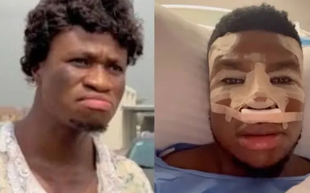 I spent about $15,000 on rhinoplasty surgery — Skitmaker, Zicsaloma