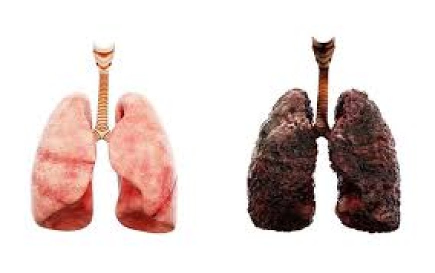 Seven ways non-smokers can get lung cancer