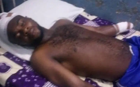 Delta community protests amputation of 28-yr-old man’s hand by herdsmen