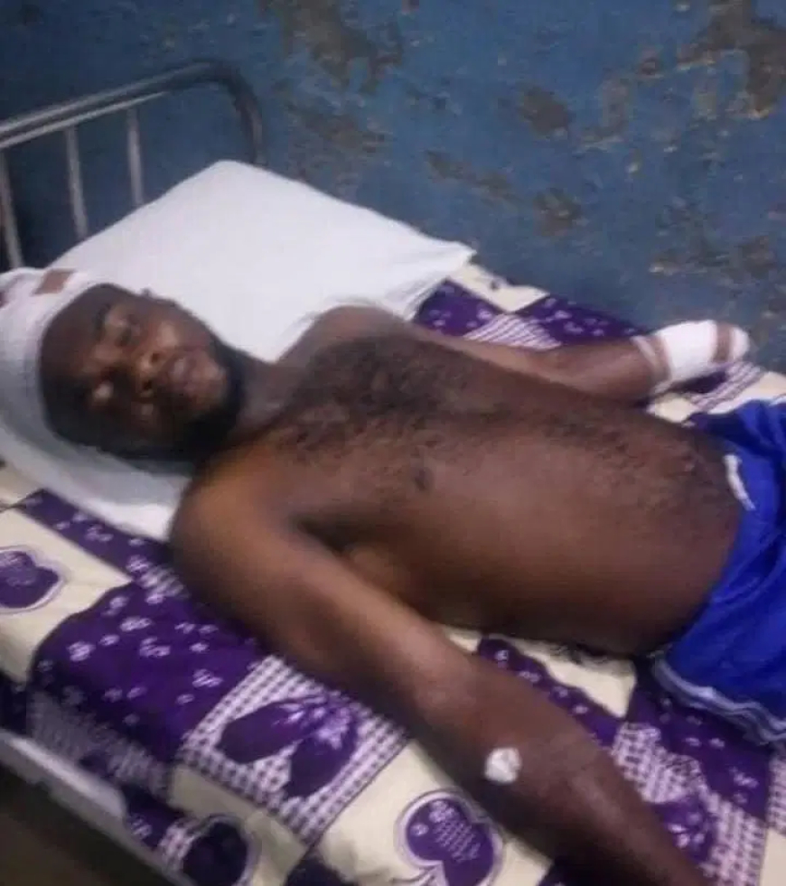 Delta community protests amputation of 28-yr-old man’s hand by herdsmen