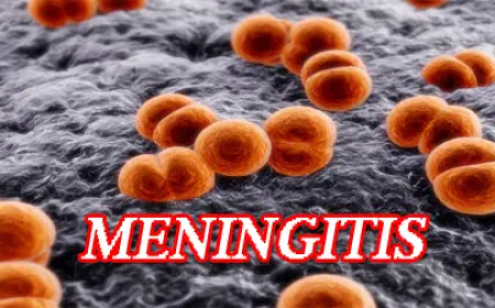 Nigeria faces meningitis outbreak with 151 deaths 1,826 suspected cases