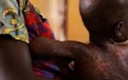 Two children die in Kaduna measles outbreak
