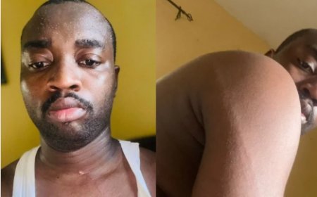 He flogged me for 30 minutes,’ Abuja churchgoer, sister recount alleged police assault
