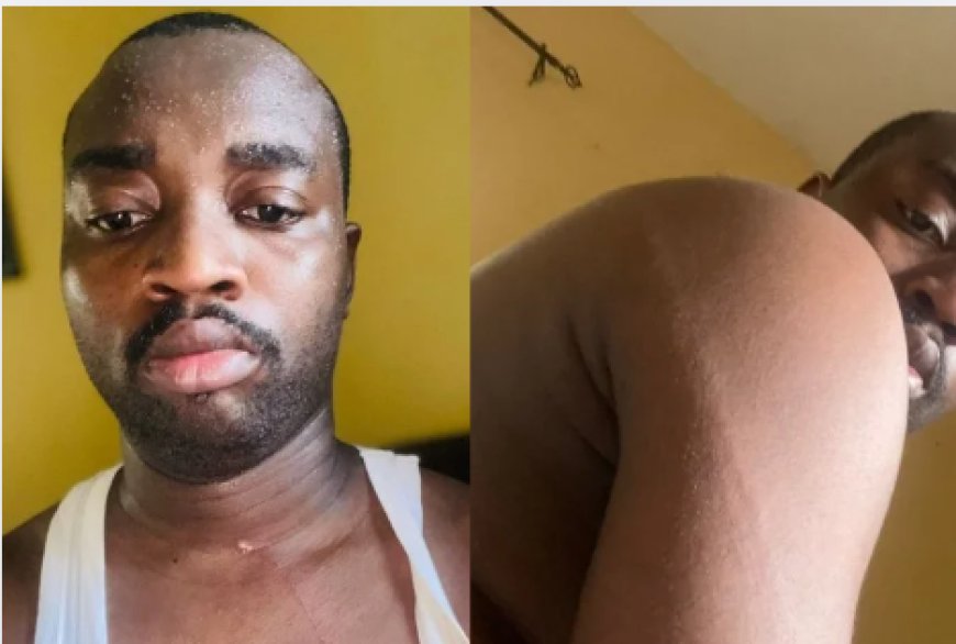 He flogged me for 30 minutes,’ Abuja churchgoer, sister recount alleged police assault
