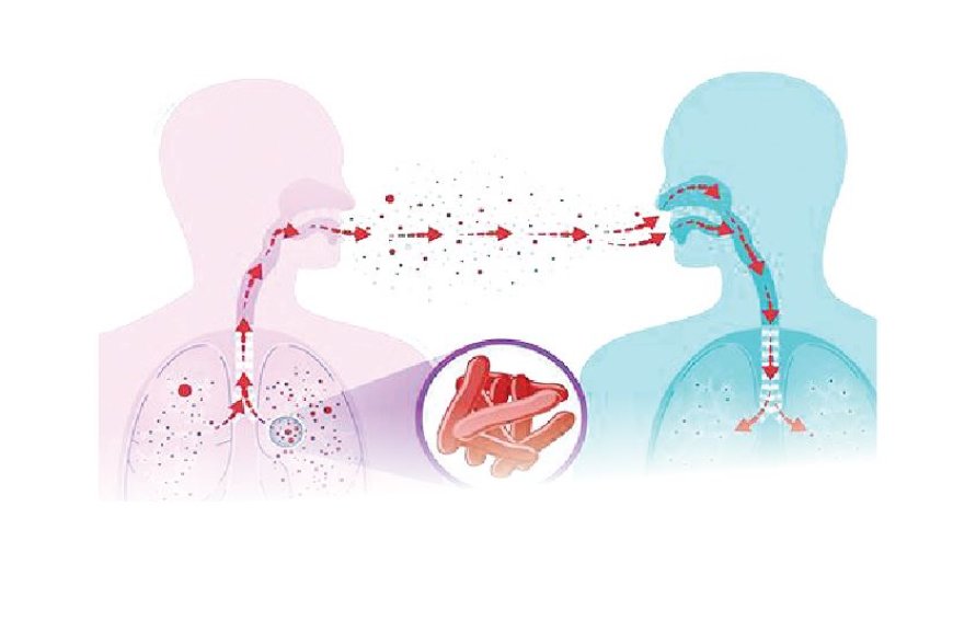 Over 50,000 Nigerians test positive for Tuberculosis – Global Fund