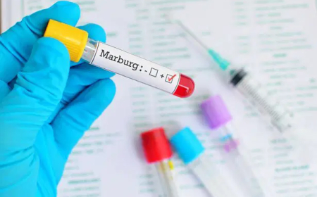 Ethiopia confirms outbreak of deadly Marburg virus