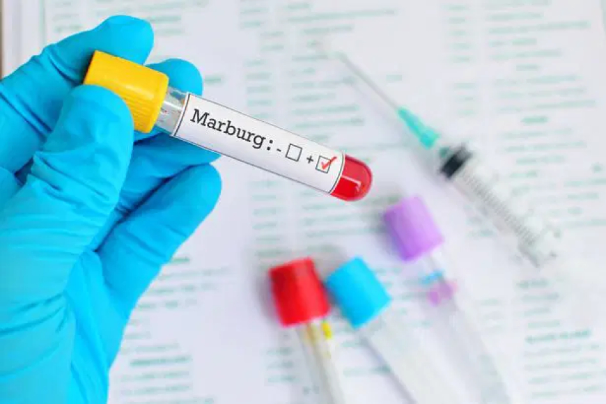 Ethiopia confirms outbreak of deadly Marburg virus