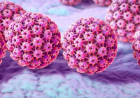 Marital status not linked to HPV, cervical dysplasia risk — Expert