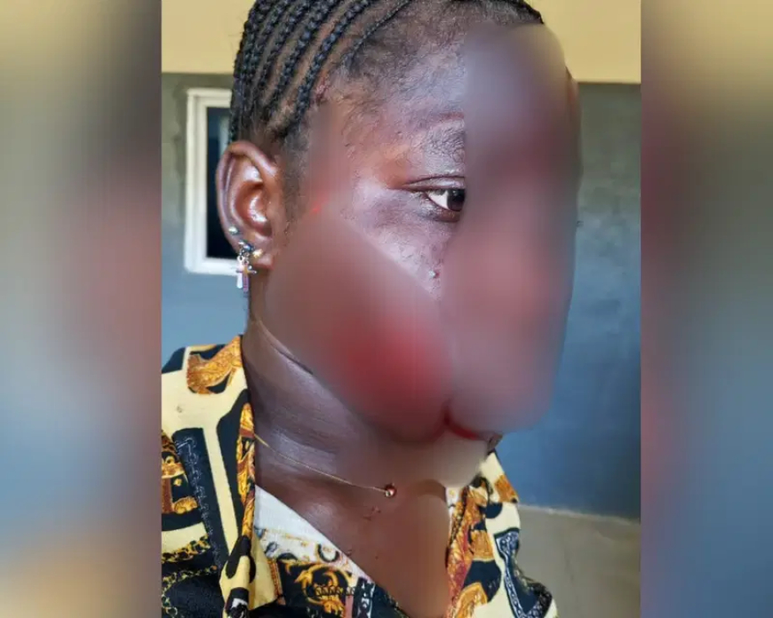 Taraba woman disfigures teenage girl’s face because husband likes her over