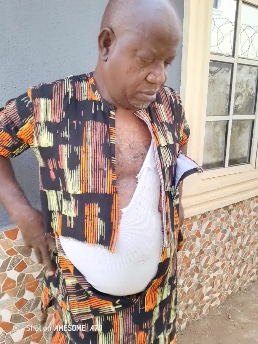 Tension in Ondo APC, armed thugs beat up state party chairman other leaders