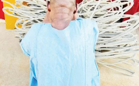 Jigawa NSCDC arrests man over stolen aluminium cable