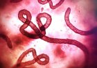 Nigeria tightens surveillance as Ebola kills 80 in Congo