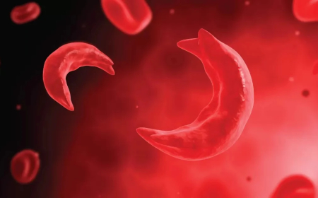 Coalition wants mandatory genotype tests before marriage to curb sickle cell