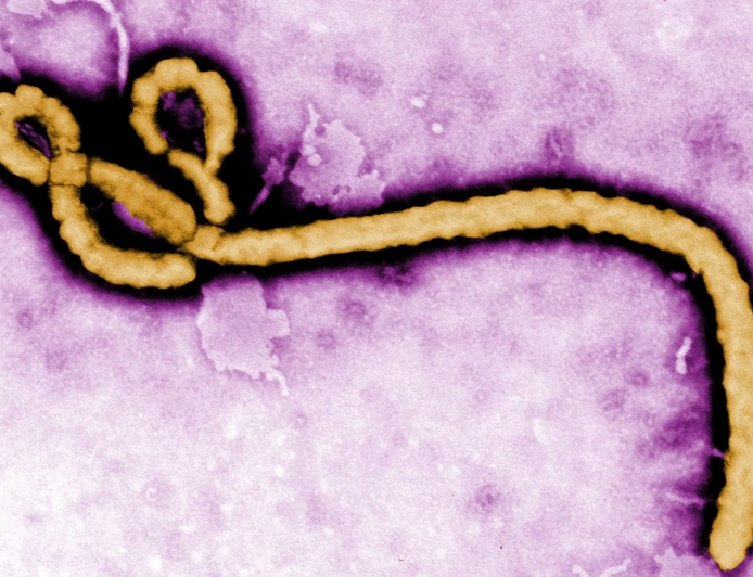 France detects first Ebola case