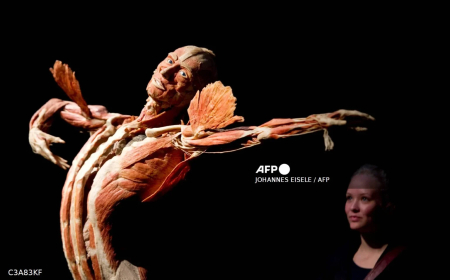 Gunther von Hagens, creator of Body Worlds, dies at 81
