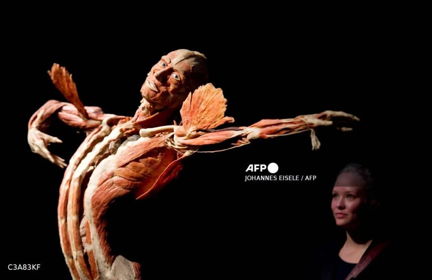 Gunther von Hagens, creator of Body Worlds, dies at 81
