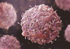 Early cancer diagnosis improves chances of effective treatment, outcome – FG
