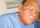 ANTP debunks cancer rumors as actor Wale Elesho undergoes facial surgery