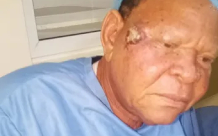 ANTP debunks cancer rumors as actor Wale Elesho undergoes facial surgery