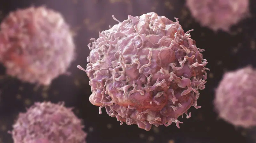 Early cancer diagnosis improves chances of effective treatment, outcome – FG