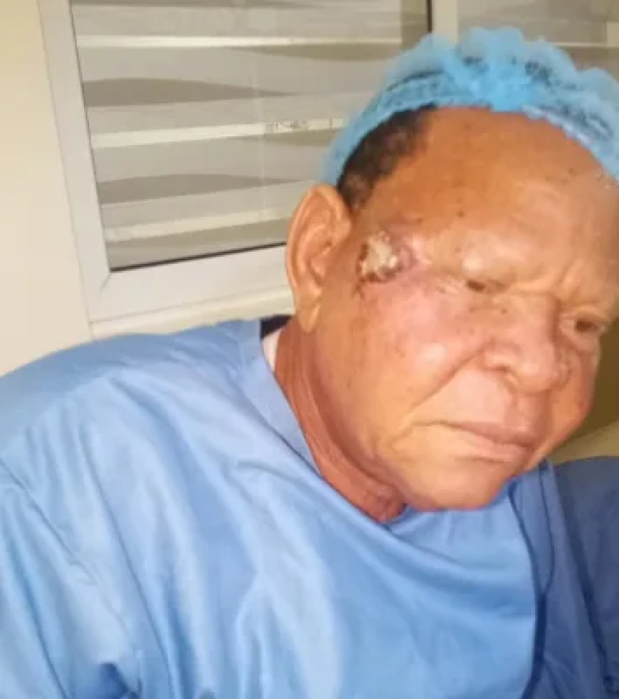 ANTP debunks cancer rumors as actor Wale Elesho undergoes facial surgery