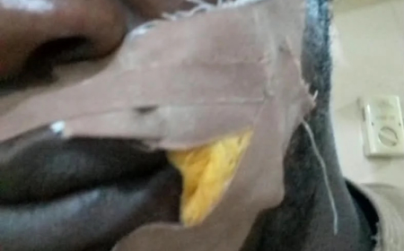 ADC supporter injured in Edo gun attack