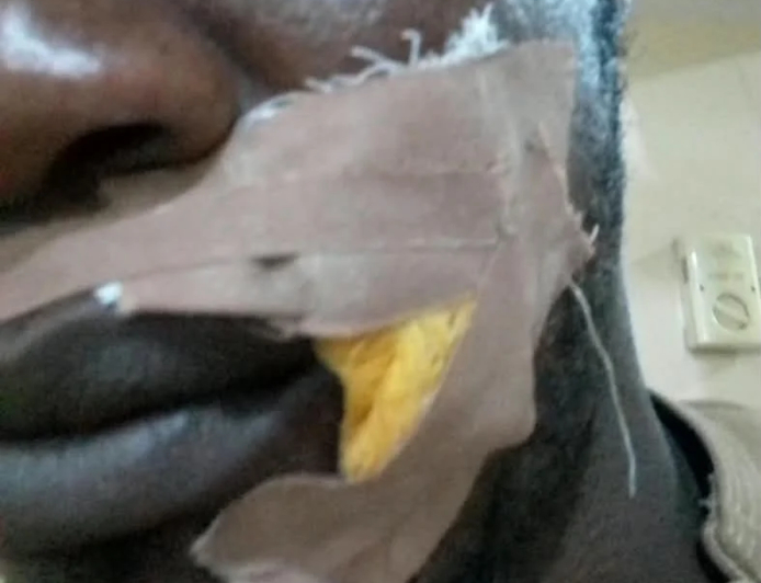 ADC supporter injured in Edo gun attack