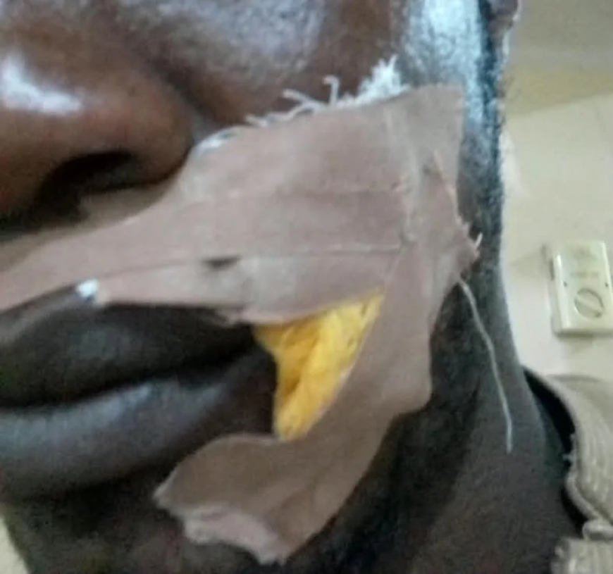 ADC supporter injured in Edo gun attack